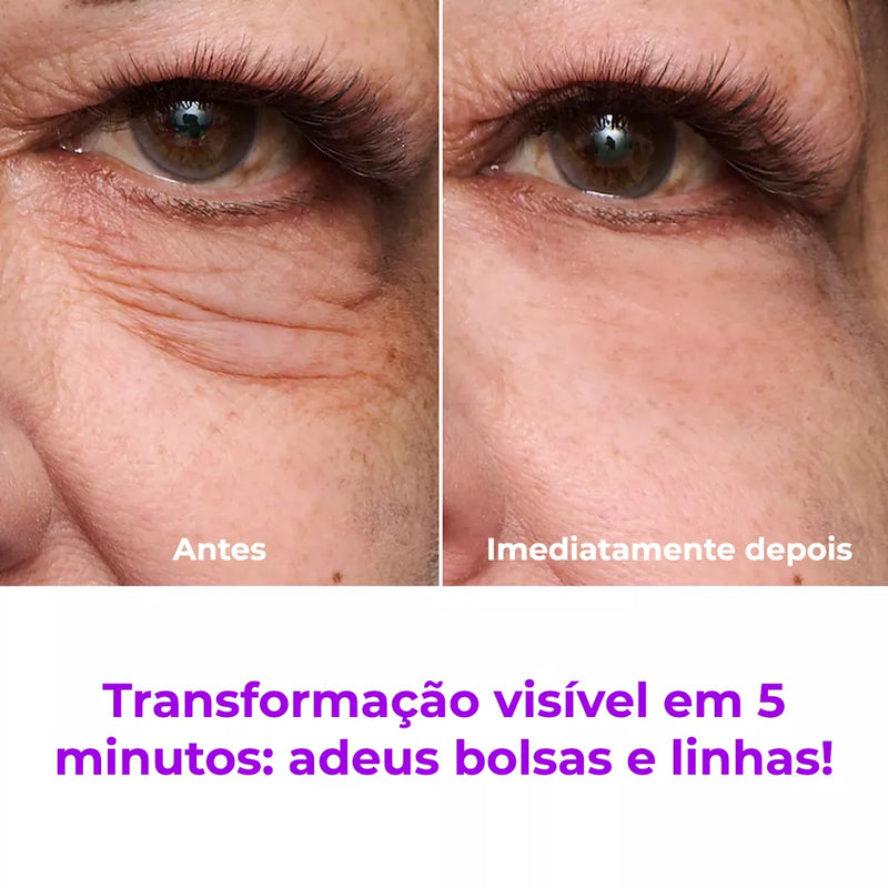 LiftBeauty - Firmador Instantâneo Que Elimina Bolsas, Rugas e Linhas Temporariamente (Oferta Exclusiva)