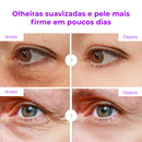 DermaLift – Bastão Firmador de Cálcio que Reativa a Elasticidade da Pele e Clareia as Olheiras